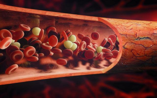 Bolest vena - veliki problem i lako rešenje